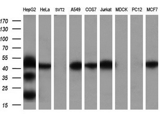 Western blot analysis of extracts (35ug) from 9 different cell lines by using anti-FDFT1 monoclonal antibody at 1:200 dilution
