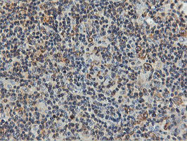 m05118 2 anti fdft1 mouse monoclonal antibody clone id oti2f10 ihc testing 10