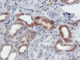 m05118 2 anti fdft1 mouse monoclonal antibody clone id oti2f10 ihc testing 11