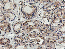 m05118 2 anti fdft1 mouse monoclonal antibody clone id oti2f10 ihc testing 4