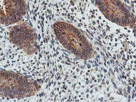 m05118 2 anti fdft1 mouse monoclonal antibody clone id oti2f10 ihc testing 5