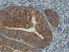 m05118 2 anti fdft1 mouse monoclonal antibody clone id oti2f10 ihc testing 6