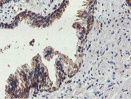 m05118 2 anti fdft1 mouse monoclonal antibody clone id oti2f10 ihc testing 7