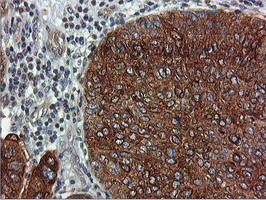m05118 2 anti fdft1 mouse monoclonal antibody clone id oti2f10 ihc testing 9