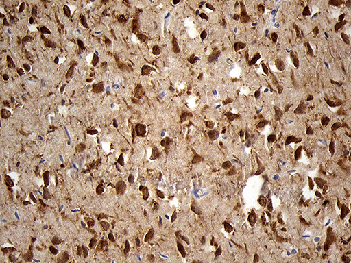 Immunohistochemical staining of paraffin-embedded Human adult brain tissue within the normal limits using anti-EEF1D mouse monoclonal antibody