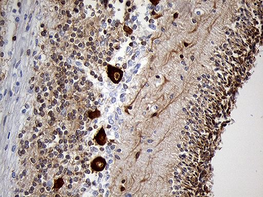 m05123 1 anti eef1d mouse monoclonal antibody clone id oti4b9 ihc testing 4