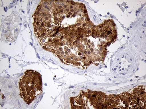 m05123 1 anti eef1d mouse monoclonal antibody clone id oti4b9 ihc testing 5