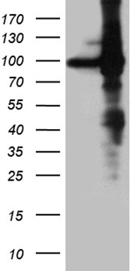 HEK293T cells were transfected with the pCMV6-ENTRY control (Left lane) or pCMV6-ENTRY EEF1D (Right lane) cDNA for 48 hrs and lysed
