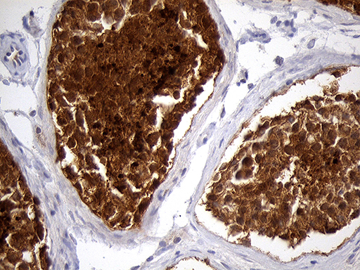 m05123 anti eef1d mouse monoclonal antibody clone id oti6b3 ihc testing 5