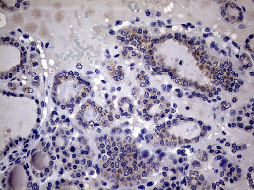 Immunohistochemical staining of paraffin-embedded Human thyroid tissue within the normal limits using anti-IL20 mouse monoclonal antibody