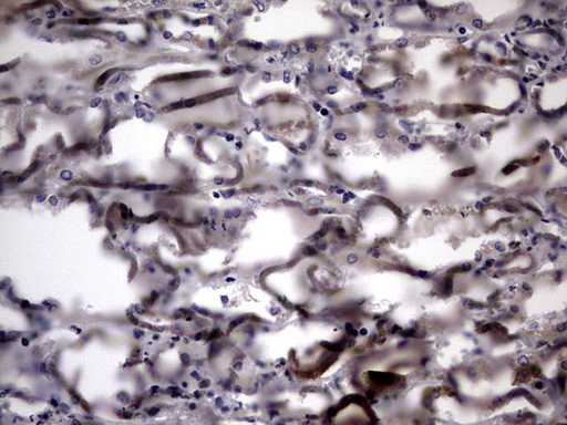 Immunohistochemical staining of paraffin-embedded Human Kidney tissue within the normal limits using anti-IL20 mouse monoclonal antibody