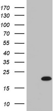 HEK293T cells were transfected with the pCMV6-ENTRY control (Left lane) or pCMV6-ENTRY IL20 (Right lane) cDNA for 48 hrs and lysed
