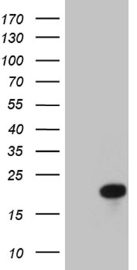 HEK293T cells were transfected with the pCMV6-ENTRY control (Left lane) or pCMV6-ENTRY RNF11 (Right lane) cDNA for 48 hrs and lysed. Equivalent amounts of cell lysates (5 ug per lane) were separated by SDS-PAGE and immunoblotted with anti-RNF11.