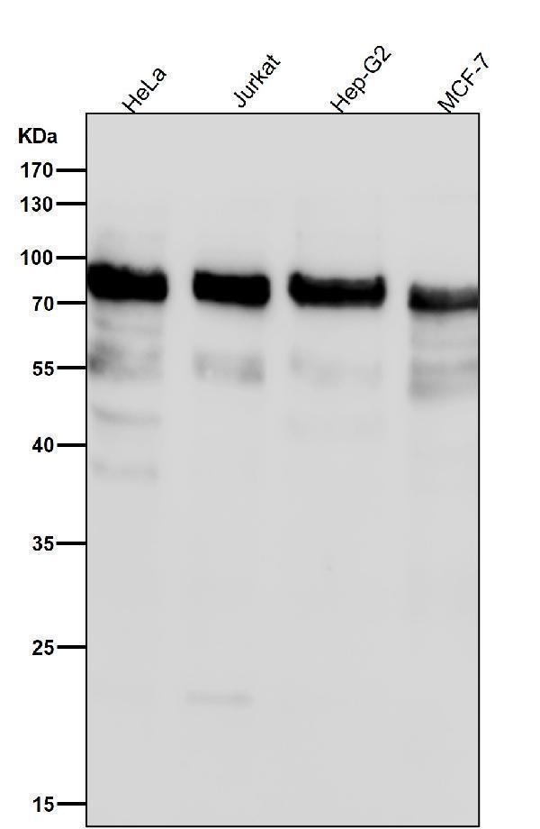 All lanes use the Antibody at 1:1K dilution for 1 hour at room temperature