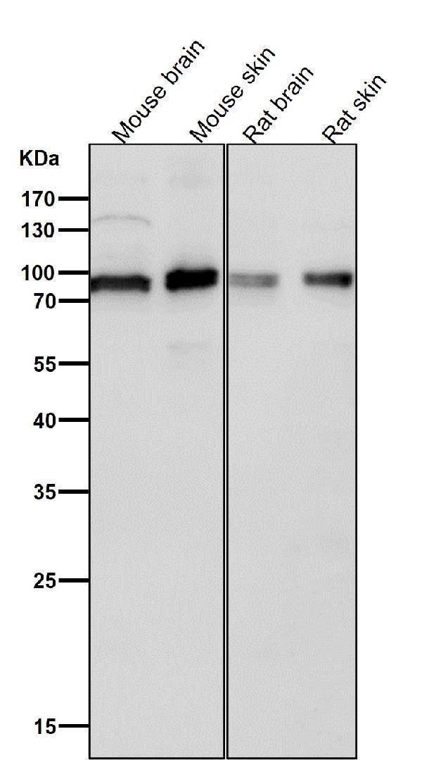 All lanes use the Antibody at 1:1K dilution for 1 hour at room temperature
