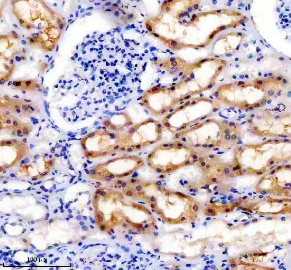IHC analysis of DcR2/TNFRSF10D using anti-DcR2/TNFRSF10D antibody (M05136-2)