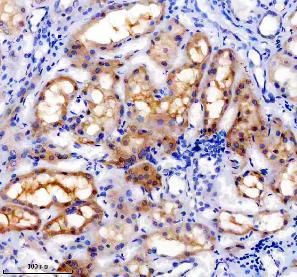 IHC analysis of DcR2/TNFRSF10D using anti-DcR2/TNFRSF10D antibody (M05136-2)