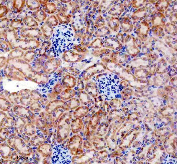 m05136 2 tnfrsf10d primary antibodies ihc testing 3