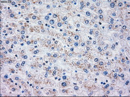 Immunohistochemical staining of paraffin-embedded Human liver tissue within the normal limits using anti-OXSR1 mouse monoclonal antibody