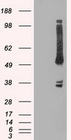 HEK293T cells were transfected with the pCMV6-ENTRY control (Left lane) or pCMV6-ENTRY OXSR1 (Right lane) cDNA for 48 hrs and lysed