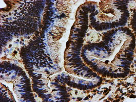 m05147 1 anti endo g endog mouse monoclonal antibody clone id oti5f1 ihc testing 7