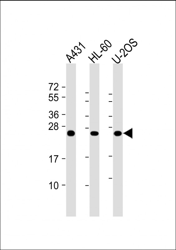 m05148 anti rab5c antibody wb testing 1