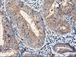 m05157 anti cdkn3 mouse monoclonal antibody clone id oti2e11 ihc testing 4