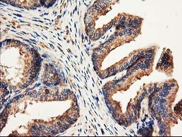 m05157 anti cdkn3 mouse monoclonal antibody clone id oti2e11 ihc testing 5