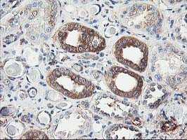 m05157 anti cdkn3 mouse monoclonal antibody clone id oti2e11 ihc testing 7