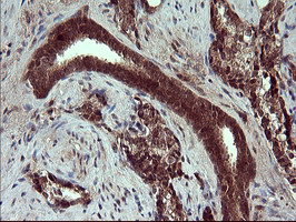 m05177 1 anti placental lactogen csh1 mouse monoclonal antibody clone id oti2g4 ihc testing 5