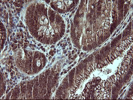 m05177 1 anti placental lactogen csh1 mouse monoclonal antibody clone id oti2g4 ihc testing 8