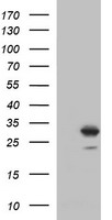 HEK293T cells were transfected with the pCMV6-ENTRY control (Left lane) or pCMV6-ENTRY CSH1 (Right lane) cDNA for 48 hrs and lysed