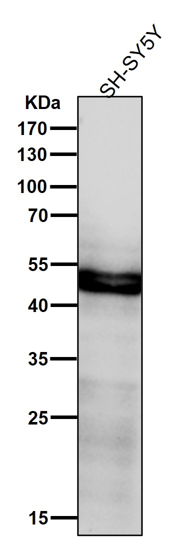 All lanes use the Antibody at 1:1K dilution for 1 hour at room temperature