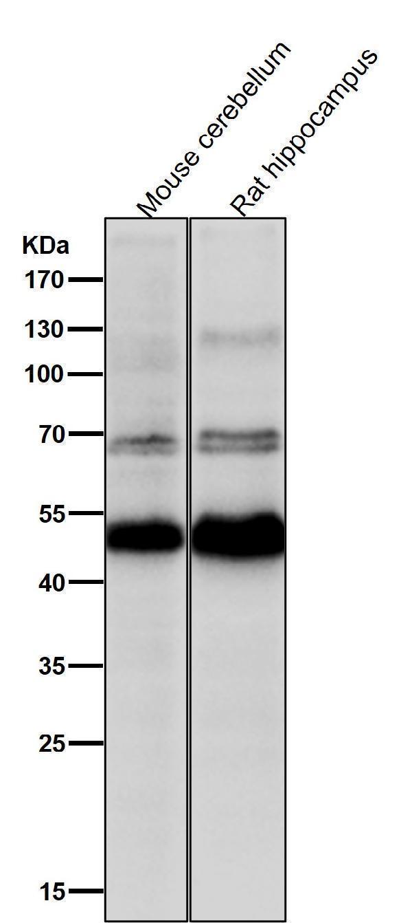 All lanes use the Antibody at 1:1K dilution for 1 hour at room temperature