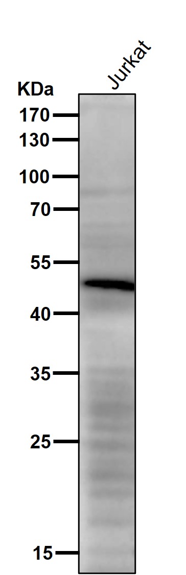 All lanes use the Antibody at 1:1K dilution for 1 hour at room temperature