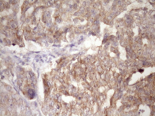 m05181 anti pin4 mouse monoclonal antibody clone id oti7h2 ihc testing 2