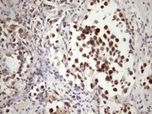 m05181 anti pin4 mouse monoclonal antibody clone id oti7h2 ihc testing 5
