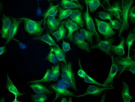 m05184 anti beta iv tubulin tubb4a mouse monoclonal antibody clone id oti3c12 if testing 16