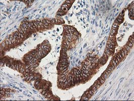 m05184 anti beta iv tubulin tubb4a mouse monoclonal antibody clone id oti3c12 ihc testing 11