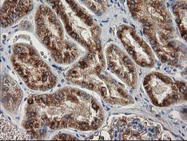 m05184 anti beta iv tubulin tubb4a mouse monoclonal antibody clone id oti3c12 ihc testing 12