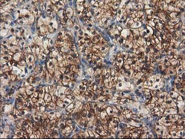 m05184 anti beta iv tubulin tubb4a mouse monoclonal antibody clone id oti3c12 ihc testing 13