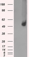 HEK293T cells were transfected with the pCMV6-ENTRY control (Left lane) or pCMV6-ENTRY SLC2A5 (Right lane) cDNA for 48 hrs and lysed