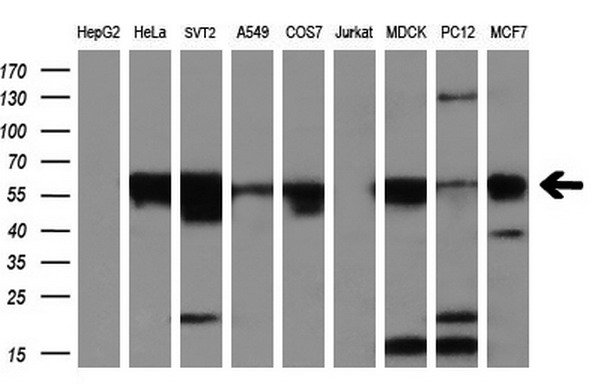 Western blot analysis of extracts (35ug) from 9 different cell lines by using anti-SLC2A5 monoclonal antibody (HepG2: human; HeLa: human; SVT2: mouse; A549: human; COS7: monkey; Jurkat: human; MDCK: canine; PC12: rat; MCF7: human) (1:200)