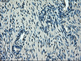 Immunohistochemical staining of paraffin-embedded Human Ovary tissue within the normal limits using anti-SLC2A5 mouse monoclonal antibody