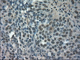 m05185 anti glucose transporter 5 glut5 slc2a5 mouse monoclonal antibody clone id oti9f3 ihc testing 4