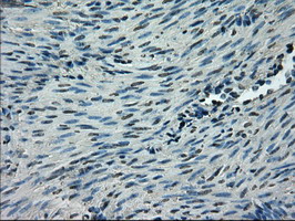 m05185 anti glucose transporter 5 glut5 slc2a5 mouse monoclonal antibody clone id oti9f3 ihc testing 5
