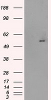 HEK293T cells were transfected with the pCMV6-ENTRY control (Left lane) or pCMV6-ENTRY SLC2A5 (Right lane) cDNA for 48 hrs and lysed