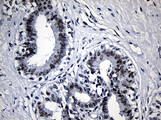 Immunohistochemical staining of paraffin-embedded Human breast tissue within the normal limits using anti-SUPT16H mouse monoclonal antibody