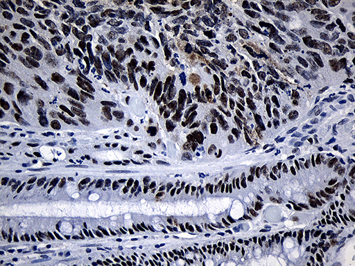 m05199 anti supt16h mouse monoclonal antibody clone id oti8a1 ihc testing 4