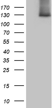 HEK293T cells were transfected with the pCMV6-ENTRY control (Left lane) or pCMV6-ENTRY SUPT16H (Right lane) cDNA for 48 hrs and lysed